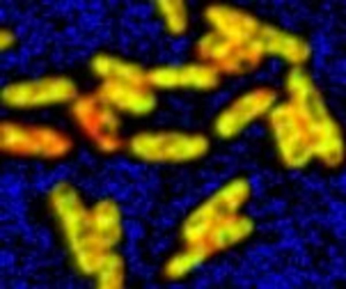 ProVIS - Centre for chemical microscopy | Peer 2025